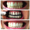 Os dentes polonês ativaram os dentes do carvão vegetal que whitening o produto comestível do pó
